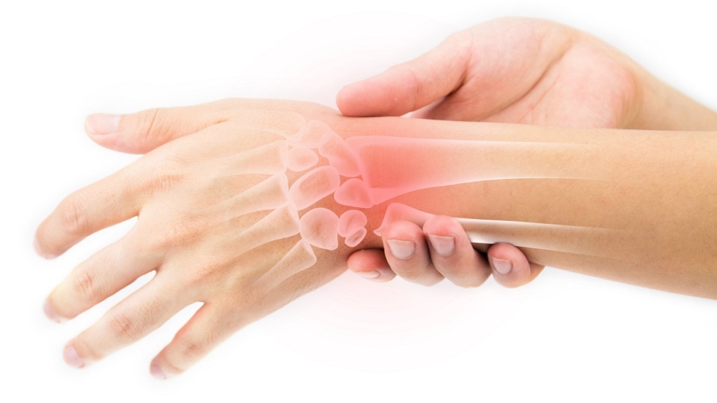 Chấn thương ở cổ tay cũng có thể gây đau. Chấn thương cổ tay bao gồm: bong gân, gãy xương và viêm gân.