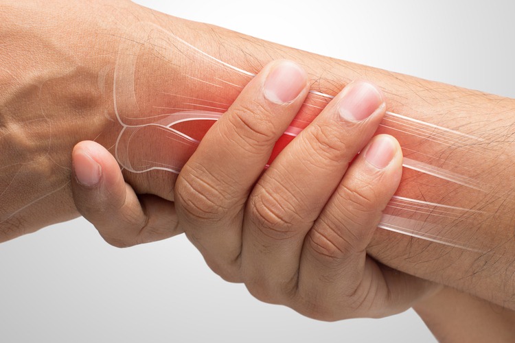 Viêm khớp là tình trạng viêm các khớp. Tình trạng này có thể gây sưng và cứng ở phần cơ thể bị ảnh hưởng. Viêm khớp có nhiều nguyên nhân, bao gồm hao mòn bình thường, lão hóa và làm việc quá sức của bàn tay.