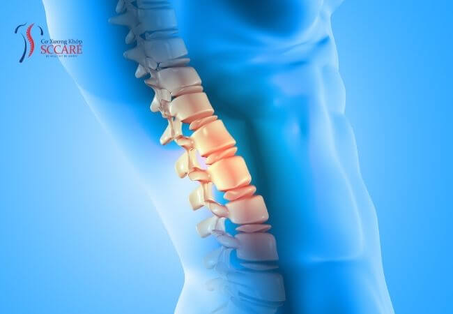cách trị đau cột sống thắt lưng vừa hiệu quả vừa tiết kiệm chi phí