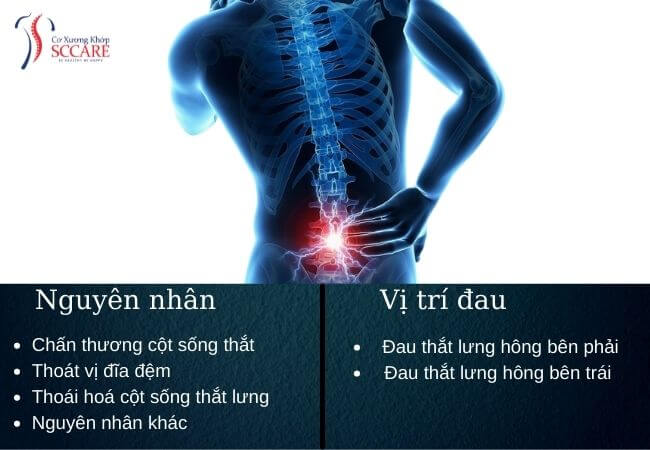 nguyên nhân và vị trí đau thắt lưng hông